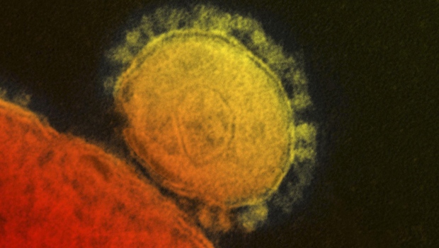 WHO: MERS virus isn’t an emergency—yet