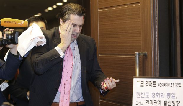 Knife-wielding attacker slashes face of US ambassador in South Korea