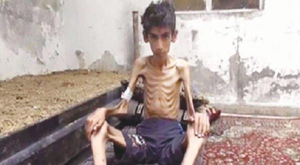 Assad and Hezbollah Supporters Mock Famine in Madaya