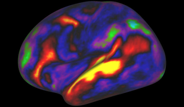 New Map Outlays Brain’s Cerebral Cortex