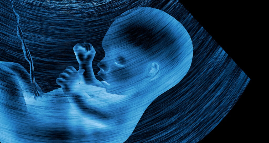 Scientists Monitor Babies in Womb through 3-D Ultrasound Scan