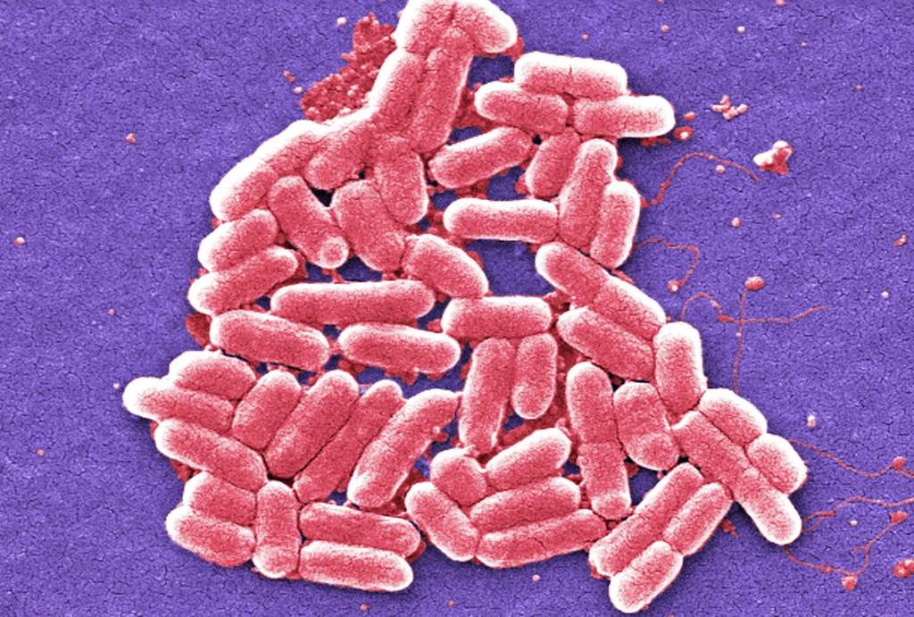 EU: ‘Alarming’ Superbugs a Risk to People, Animals and Food