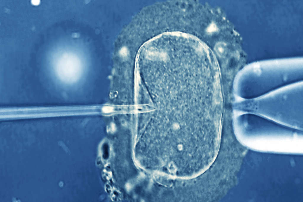 Failed IVF Linked to Heart Diseases, Study Says