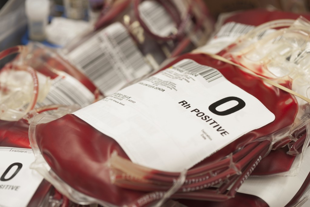 People with Blood Group O are at Lower Risk of Heart Attacks