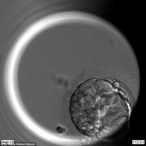 Scientists used the CRISPR-Cas9 system to 'edit' growing human embryos to see what would occur when a key gene was removed. Pictured is an edited embryo without OCT4 on the fifth day of development - it does not form a proper blastocyst