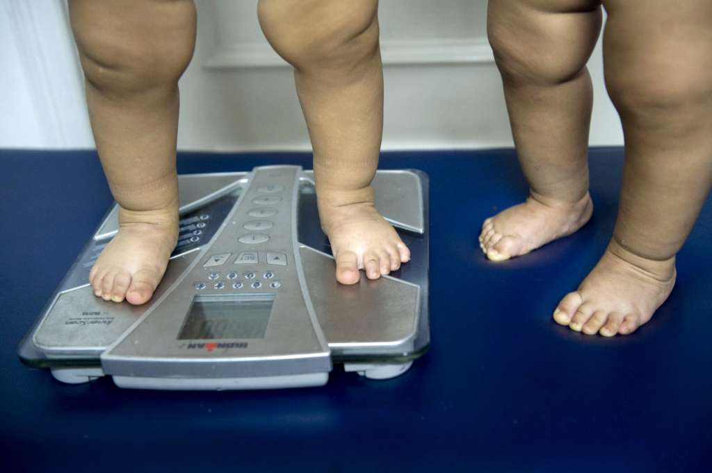 Study: Childhood Obesity Soaring in Arab World